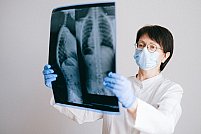 Rolul radiologiei în depistarea cancerului pulmonar