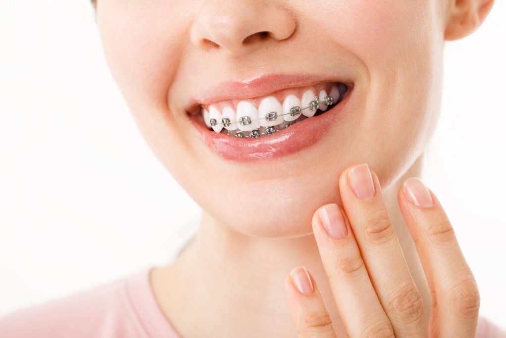 De ce este importantă identificarea și tratarea problemelor ortodontice indiferent de vârstă?