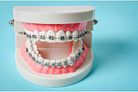 Sănătatea orală începe aici: ce trebuie să știi despre alegerea unei clinici stomatologice pentru tratamente ortodontice