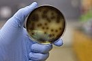 Asaltul super-germenilor patogeni nu poate fi oprit